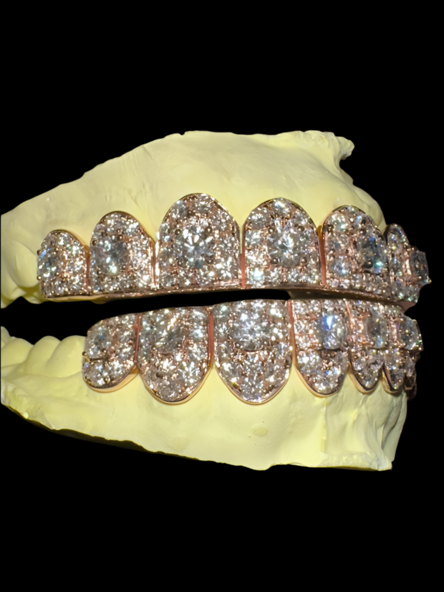 Moissanite Jumbo Solitaire Round Cut Iced Out Grillz rose plated 925 silver 8 Top 8 Bottom