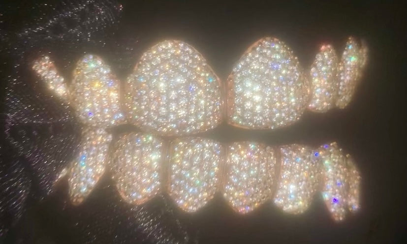 Moissanite Grillz